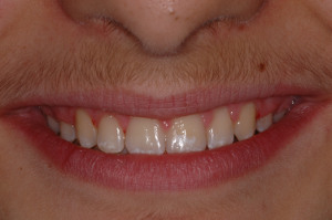 ortodonzia dopo