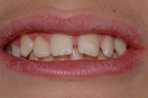 ortodonzia prima